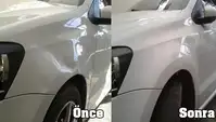 Boyasız Göçük Düzeltme